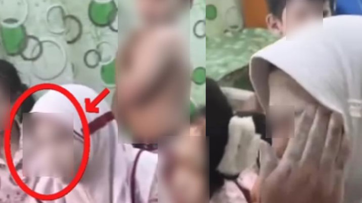 Bukan Muntah dan Pusing, Sejumlah Siswa SD di Sampang Mandura Diduga Alami Alergi Kulit Usai Santap MBG, Dibedaki Sebadan-badan