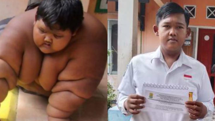 Transformasi Arya Permana Bocah Karawang yang Dulu Obesitas, Begini Kabarnya Sekarang