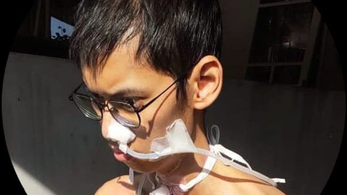 Sultan Terjerat Kabel Fiber Optik Kini Dirawat di RS Polri, Dapat Bantuan Perbaikan Gizi dari Kapolri