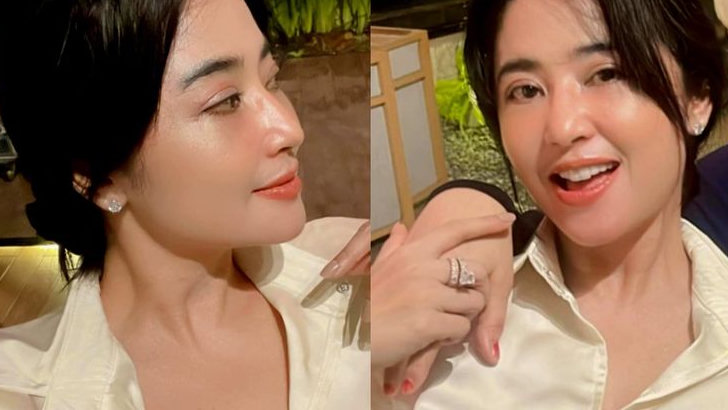 Wajah Barunya Panen Kritikan, Dewi Perssik : Aku Enggak Oplas
