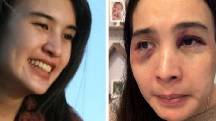 Alasan Polisi Tahan Istri Korban KDRT Depok, Tak Kooperatif dan Tolak Restorative Justice