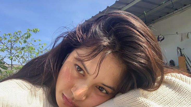 Gegara Berkulit Gelap, Aurelie Moeremans Pernah Dibilang Mirip Monyet dan Disarankan Suntik Putih