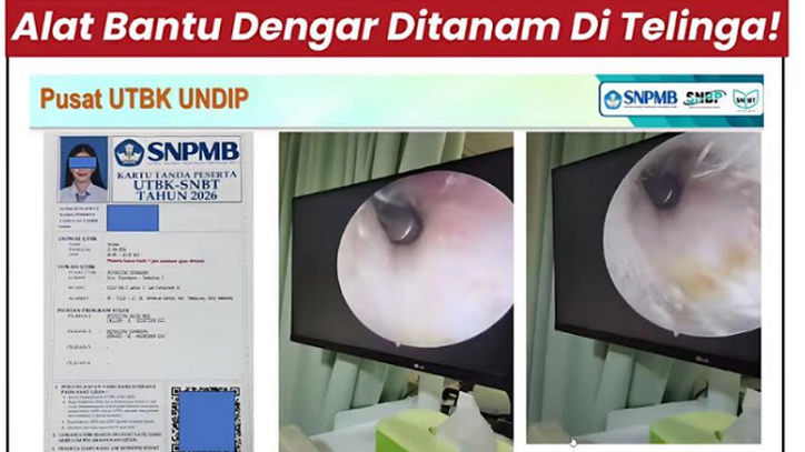 Terungkap! Dugaan Kecurangan UTBK di Undip, Ini Dampak Panjangnya yang Sering Diremehkan