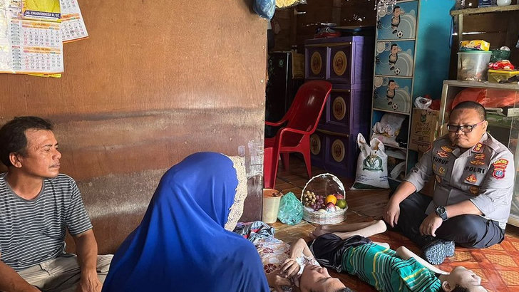 Kapolres Tanjung Balai Jenguk warga Penderita Polio Menahun