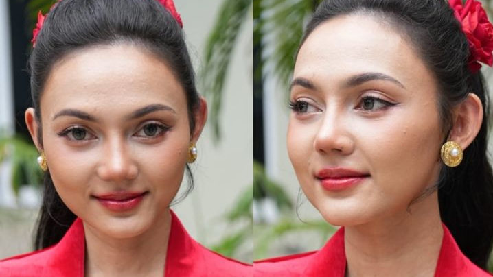 Hidung Mancung usai Oplas, Rina Nose Pastikan Tetap Gunakan Nama Panggung yang Sama