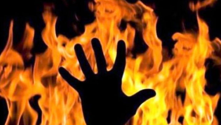 Kronologi Kasus Siswa SD di Situbondo Nyaris Tewas Usai Dibakar Temannya, Korban Disiram Cairan Spiritus