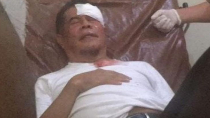 Massa Ngamuk Saat Kedatangan Jenazah Lukas Enembe, Kepala Pj Gubernur Papua Terluka, Darah Berceceran di Bajunya