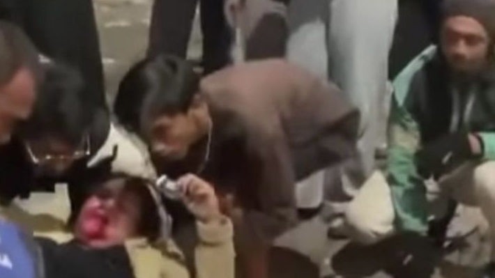 Polisi Belum Menetapkan Tersangka Kasus Pria Tabrak Pacar di Prapanca, Ini Alasannya