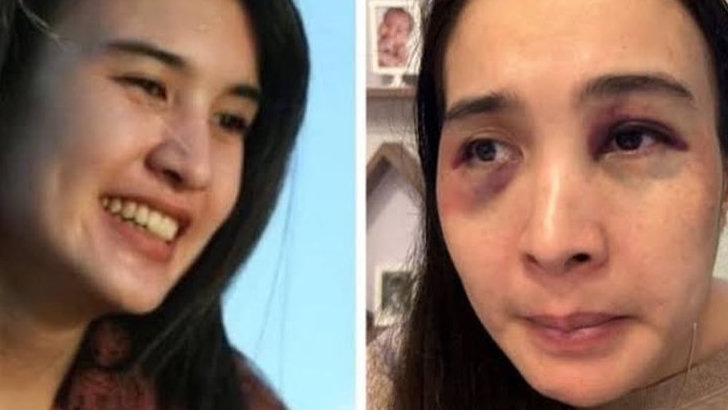 Babak Baru Kasus KDRT Depok Putri Balqis, Sang Suami Kini Jadi Tersangka dan Langsung Nginep di Sel