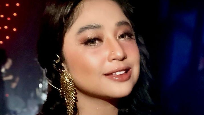 Demi Calon Suami, Dewi Perssik Rela Tampil Cantik dengan Tanam Lemak di Wajah