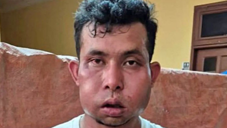 Dua Pelaku Pembunuhan Wanita Lansia di Rumbai Ditembak, Muka Bonyok, Diperiksa di Rumah Sakit