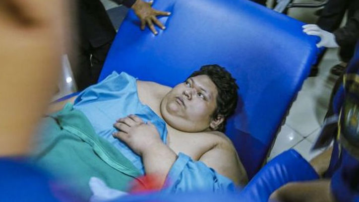 Pria Obesitas 300 Kilo Asal Tangerang Dirujuk ke RSCM, Dibawa Pakai Truk dan Forklift