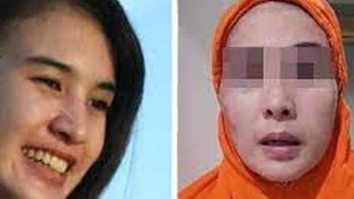 Suami Alami Pembengkakan di Organ Vital, Polda Metro Siapkan Psikolog Terkait KDRT Depok
